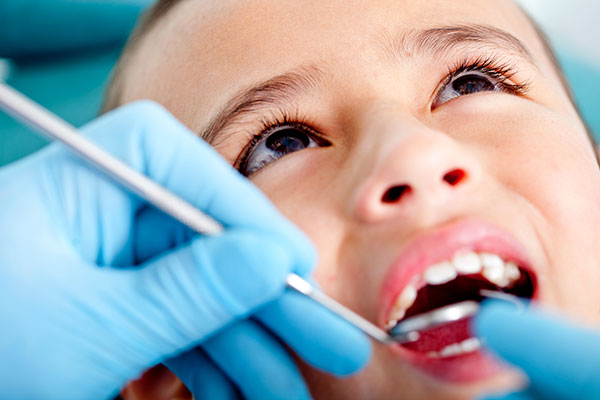 Cavity Prevention with a child's dental exam